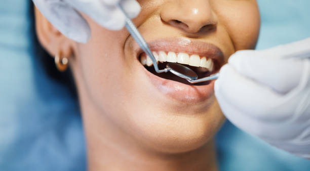 Best Emergency Treatment for Dental Infections or Abscesses in Port Jefferson Station, NY